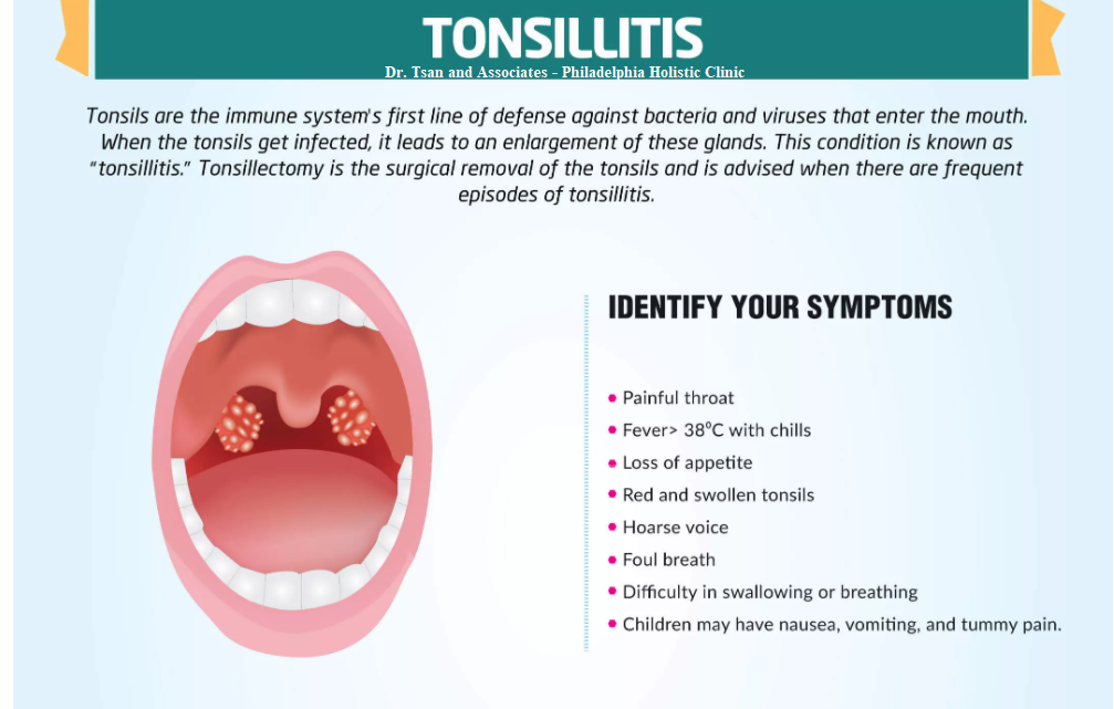 Can Tonsillitis Cause Fever And Body Aches