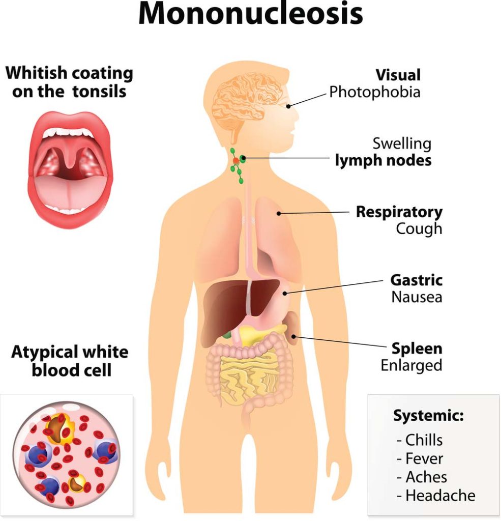 What is mono