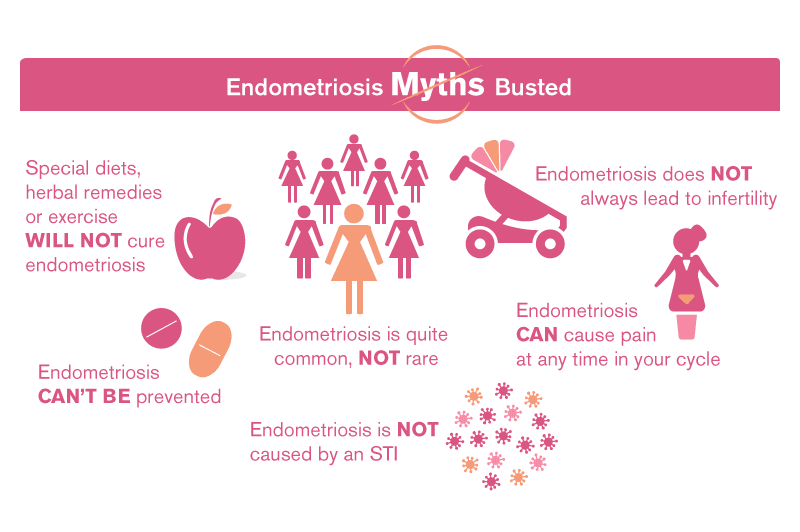 Myths-and-True about Endometriosis