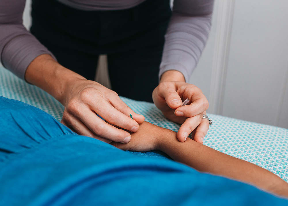 Acupuncture