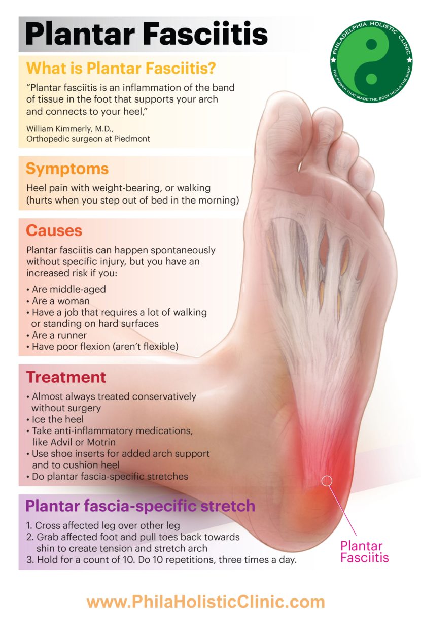 Treatment for plantar fasciitis Philadelphia Holistic Clinic