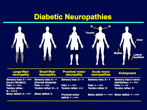 Diabetic neuropathy