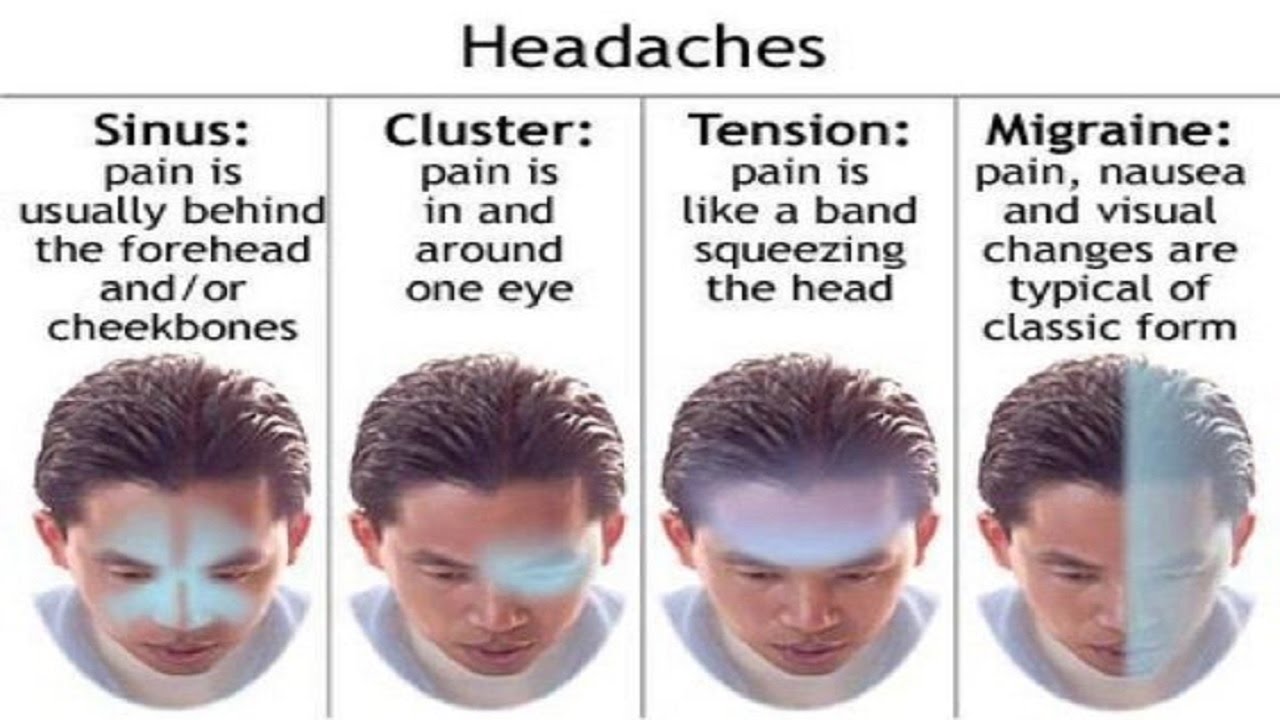 What are headaches