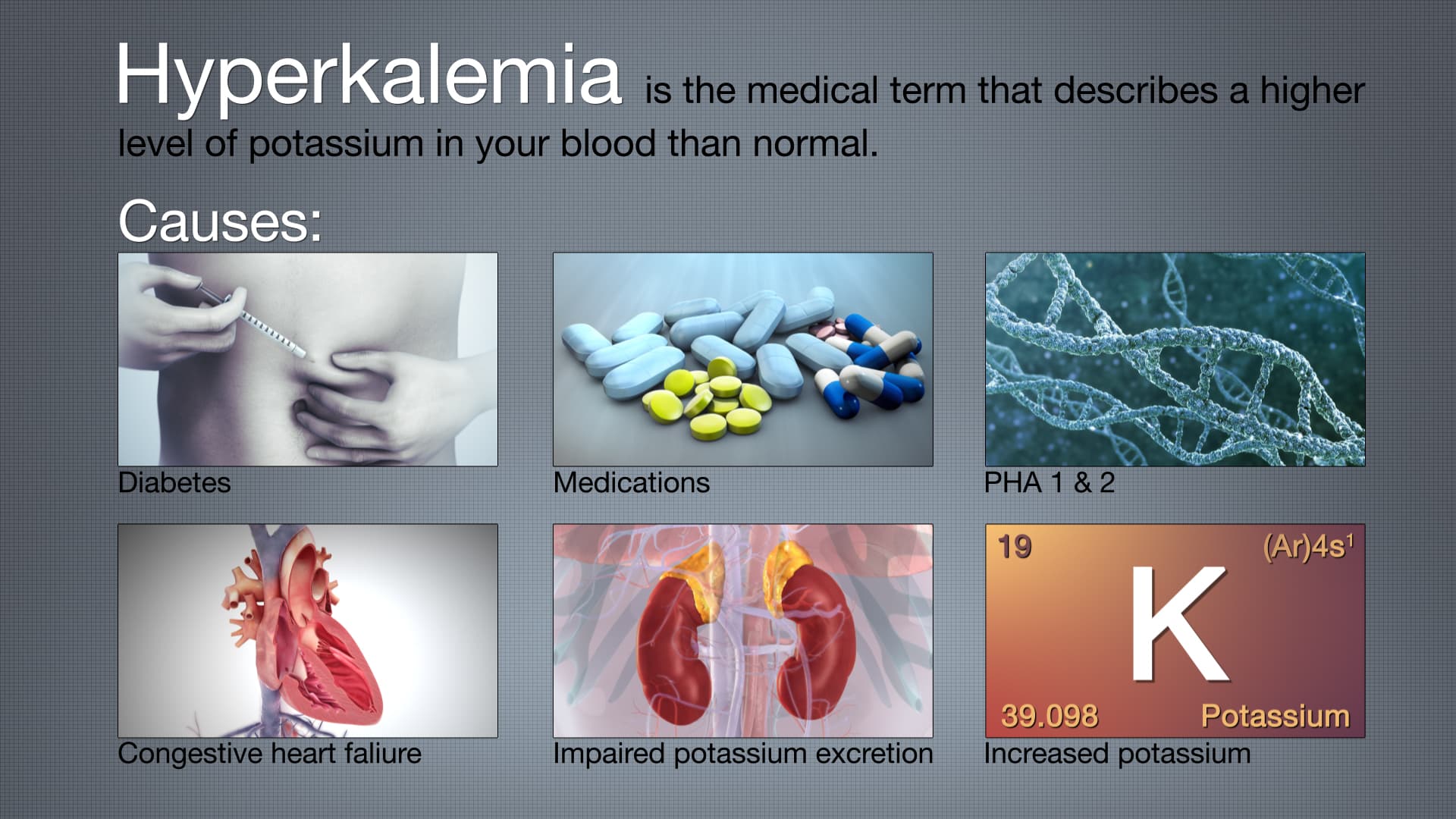 Hyperkalemia