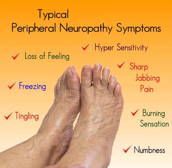 Diagnosis Code For Peripheral Neuropathy