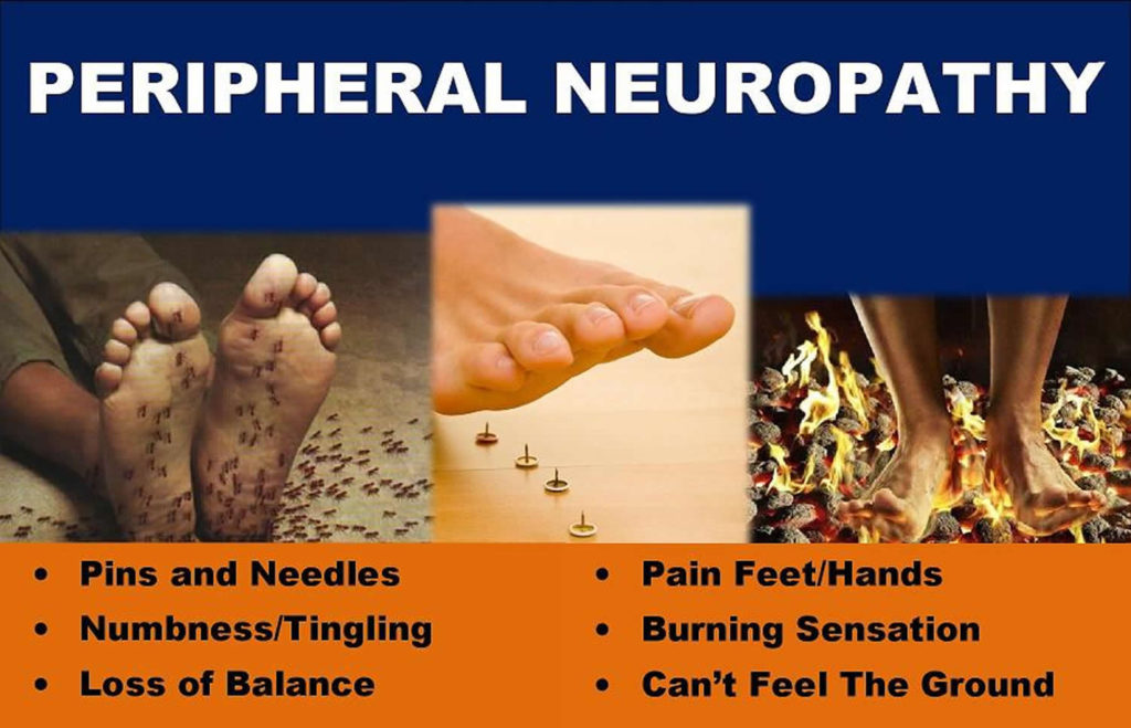 Symptoms of peripheral neuropathy