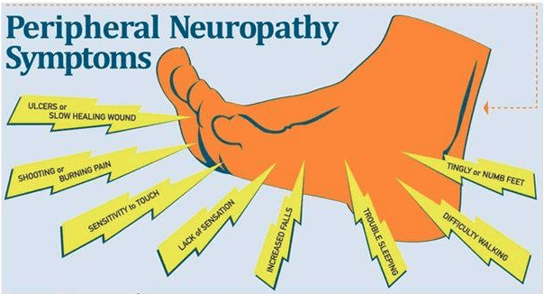 Symptoms of peripheral neuropathy