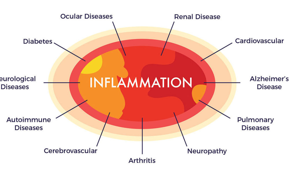 Inflammation