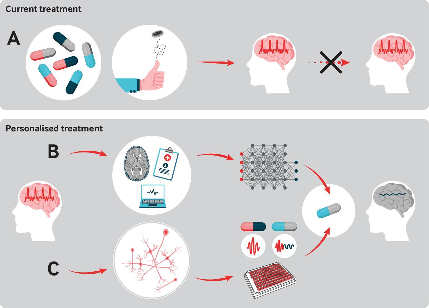 Treatment for Epilepsy