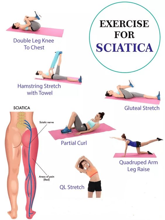 Exercises for Sciatica