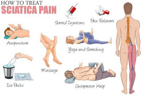 Most Popular Treatments for Sciatica