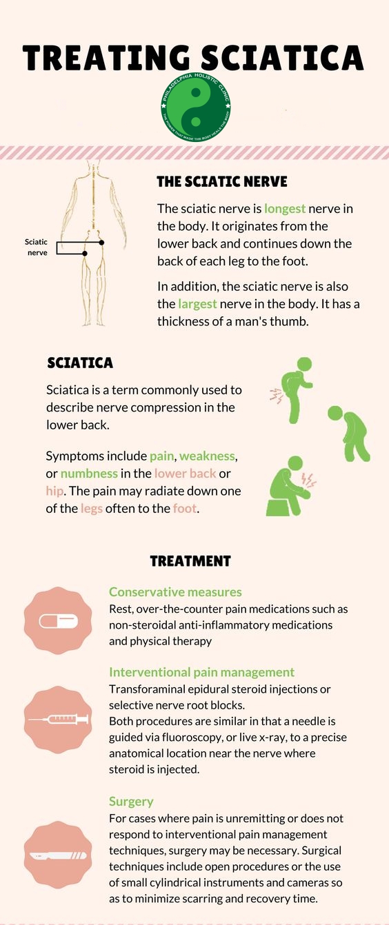 Treatment for Sciatica