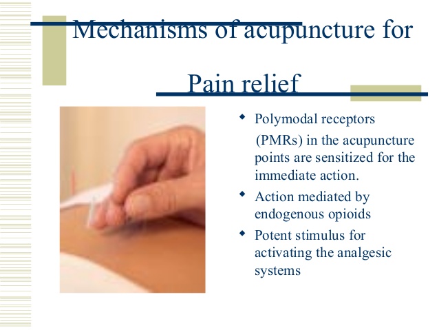 Pain relief acupuncture
