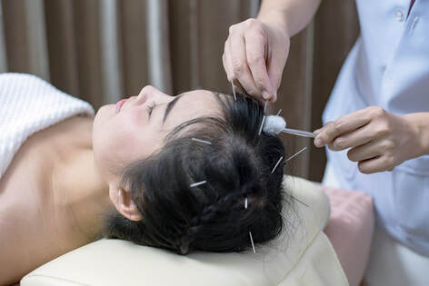 Acupuncture for tics