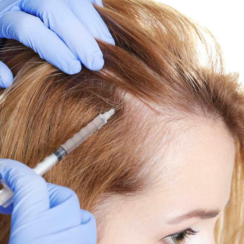 Treatment for hair loss