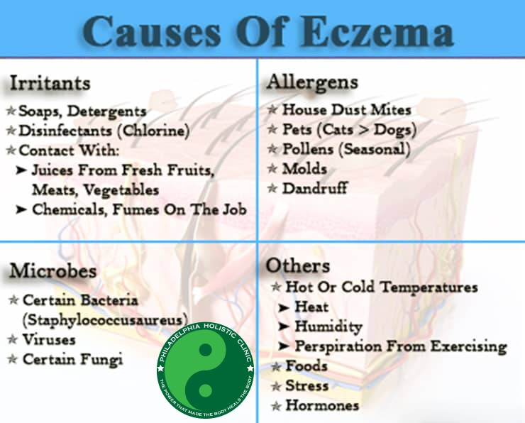 Causes of eczema