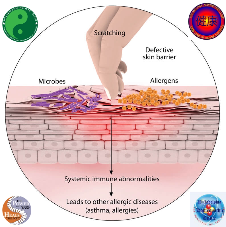 Causes of skin rashes