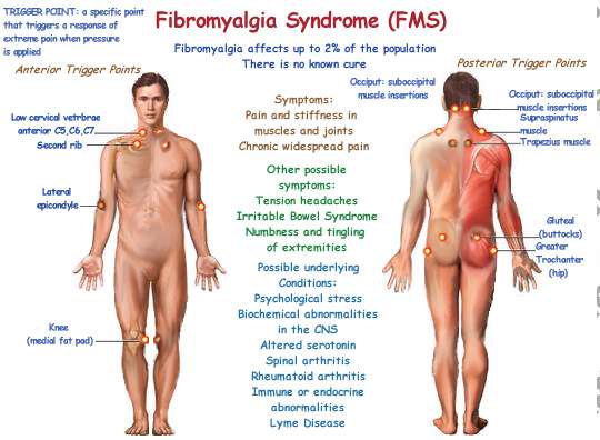 Symptoms of fibromyalgia