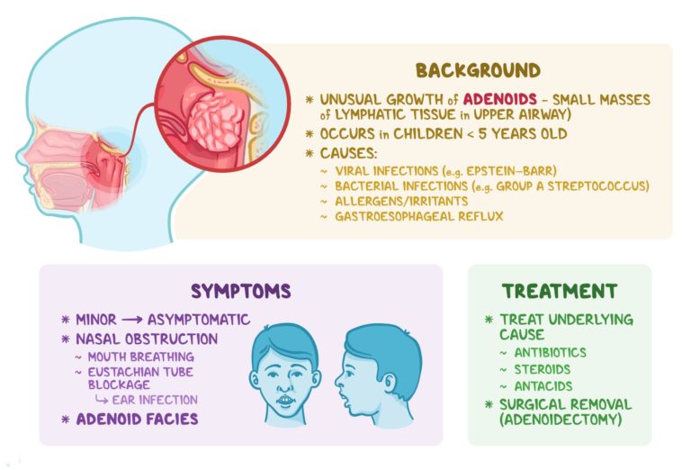 Natural Treatment for Adenoids - Philadelphia Holistic Clinic - Dr. Tsan