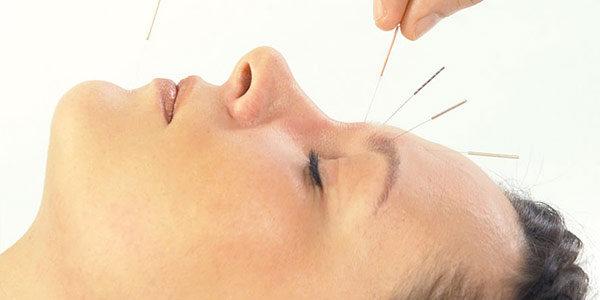 Acupuncture for Computer vision syndrome