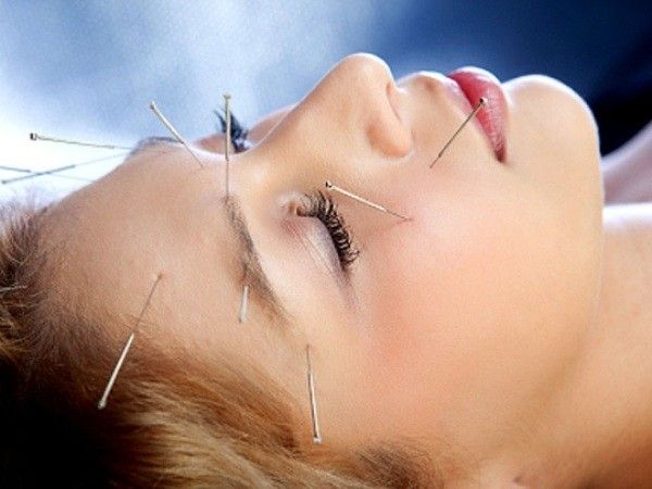 Acupuncture for eyes diseases