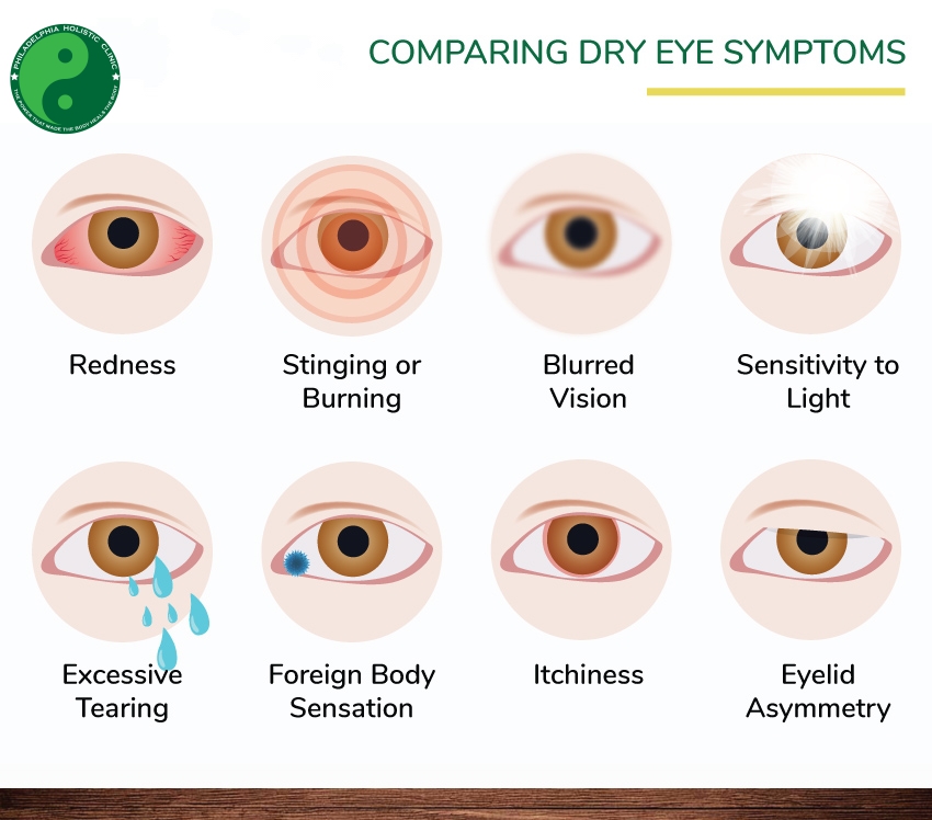 Symptoms Of Dry Eyes 