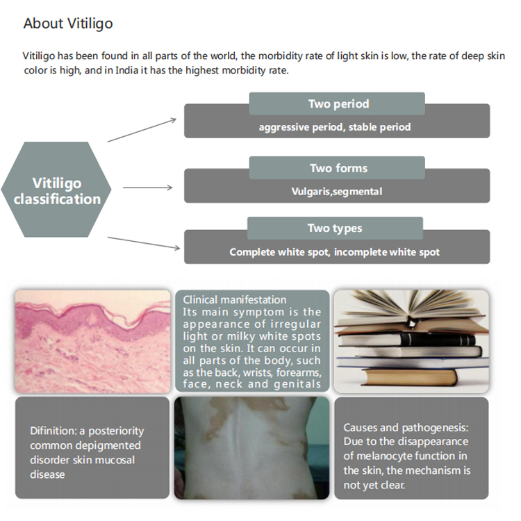 About Vitiligo