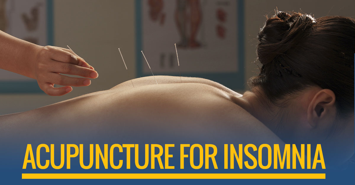 Acupuncture to fall asleep