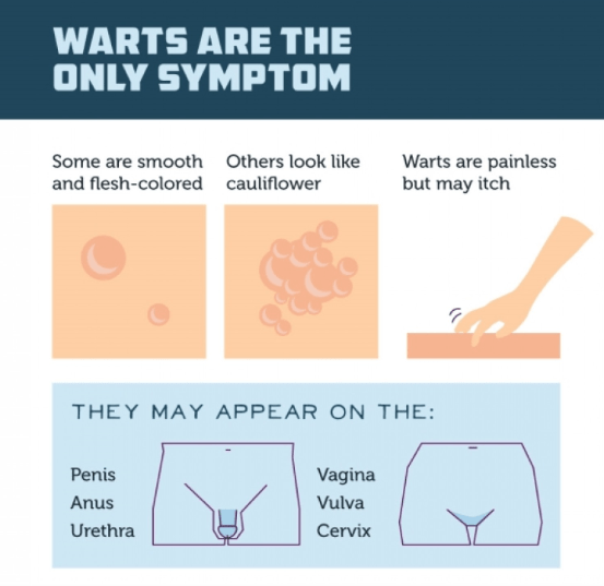 symptoms of verruca vulgaris