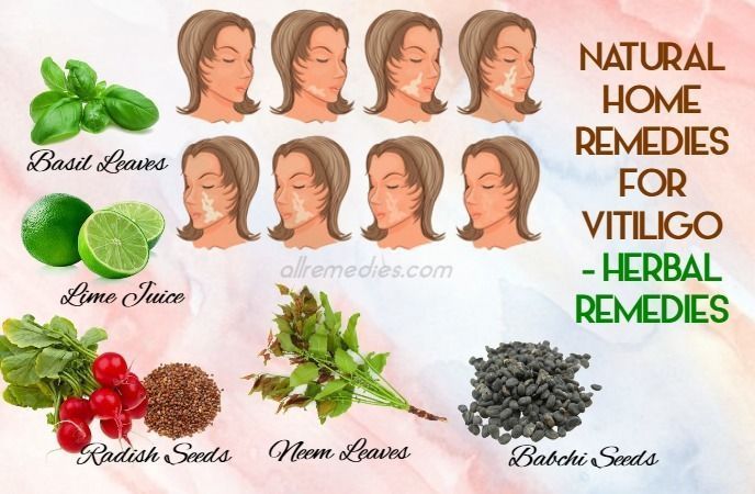 vitiligo home remedies food