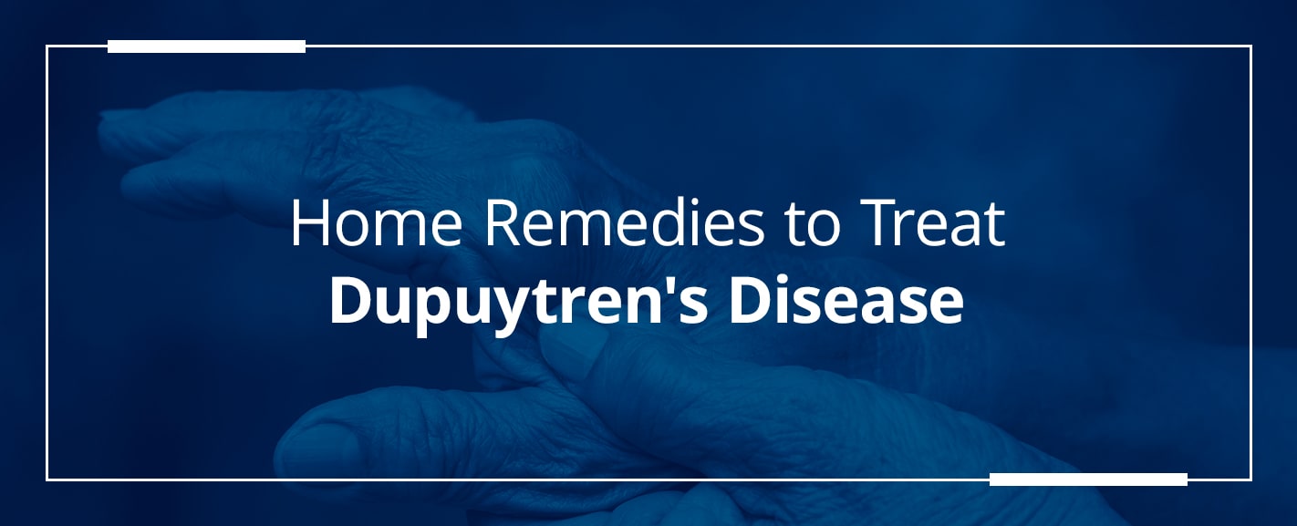 Home-remedies-to-treat-dupuytrens-disease