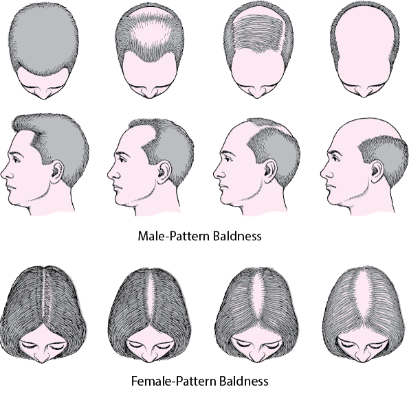 Male and female pattern