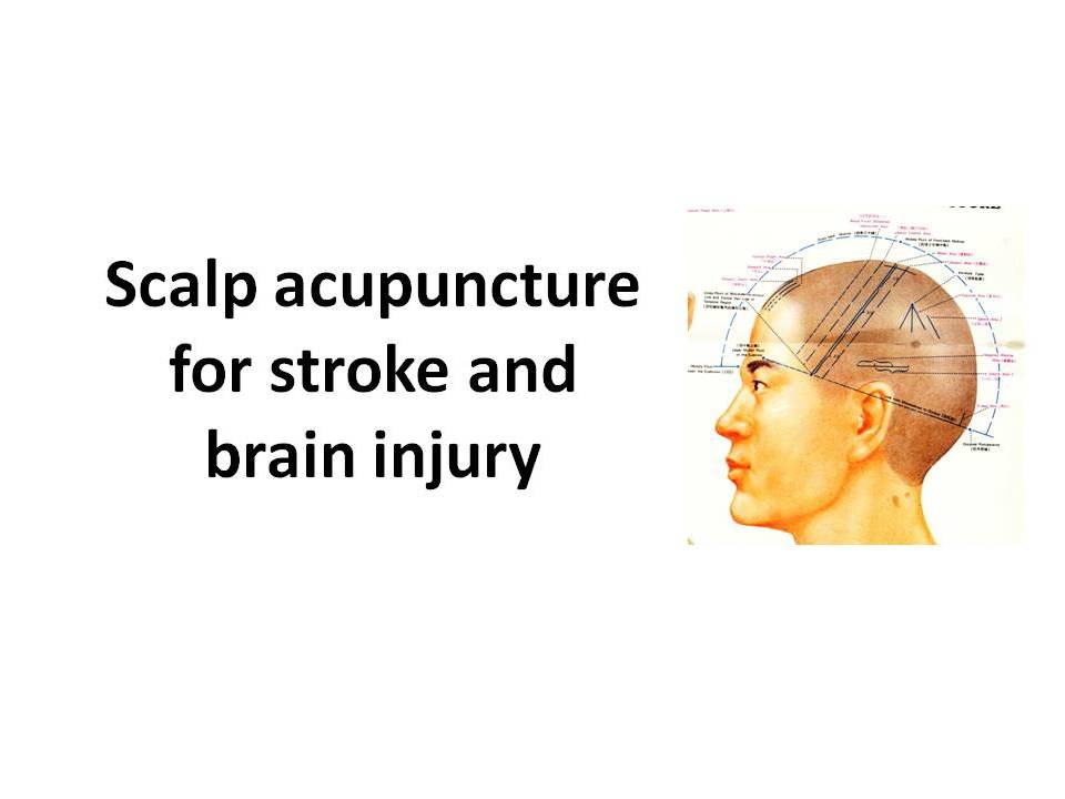 Scalp-acupuncture for brain injury