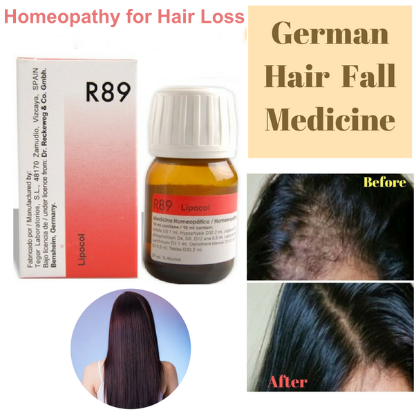 homeopathy for hair loss