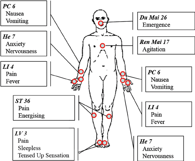 Acupuncture points