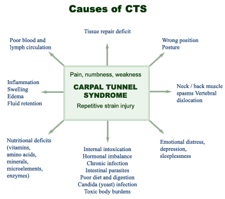 Causes of CTS