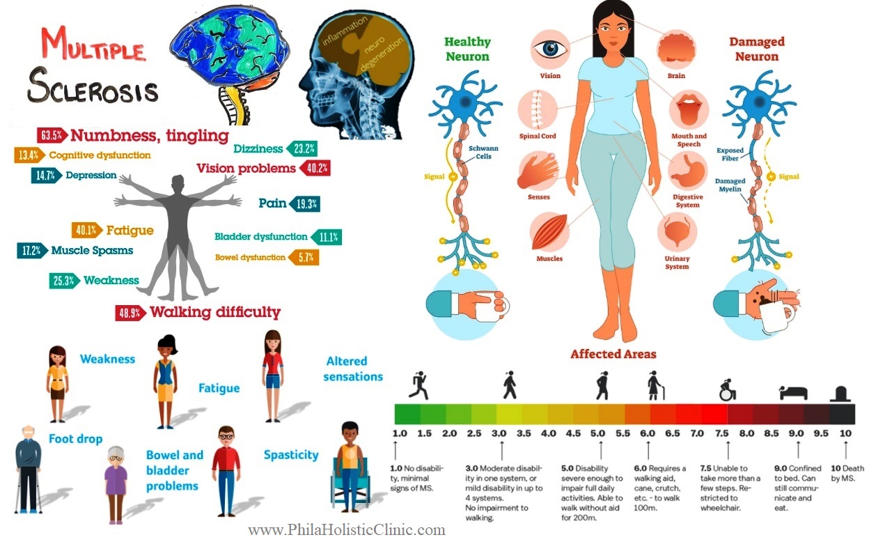 Homeopathic-treatment for multiple sclerosis