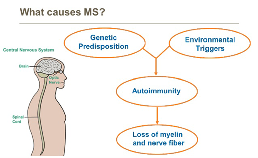 What causes MS