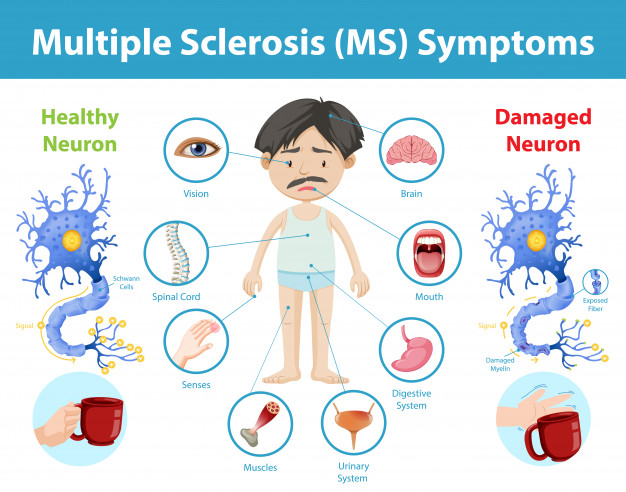 MS - symptoms in men