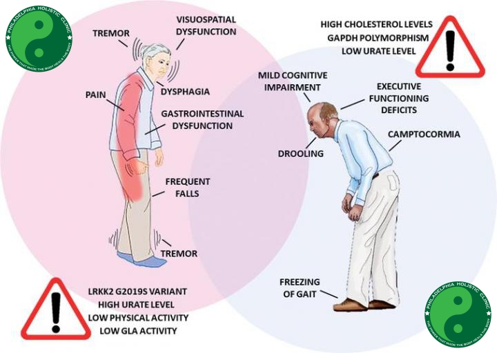 Parkinson's disease