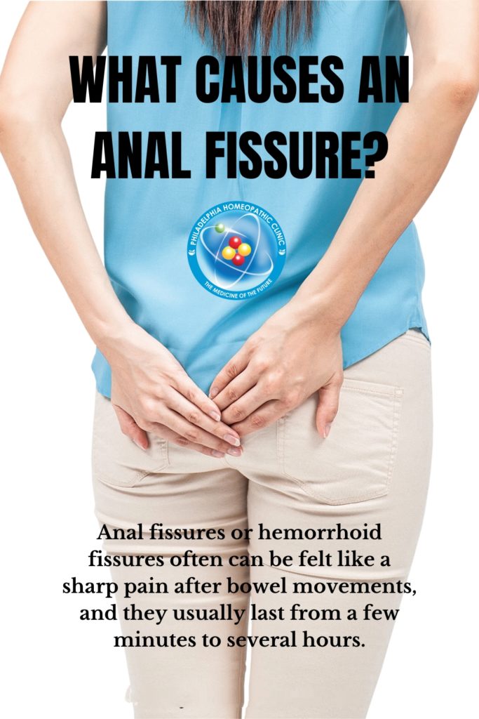 anal fissures