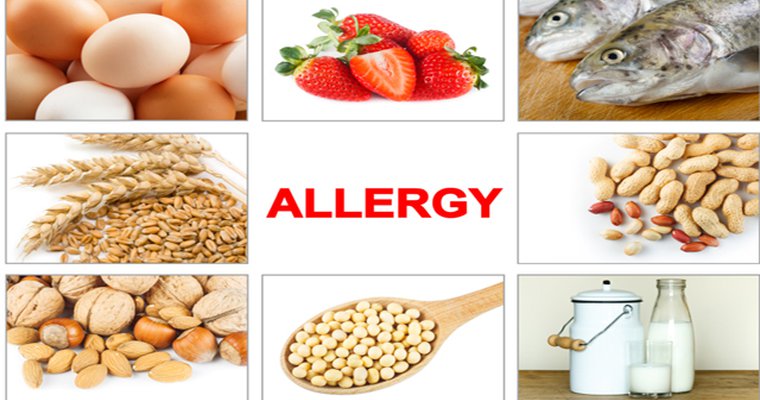 Food allergies