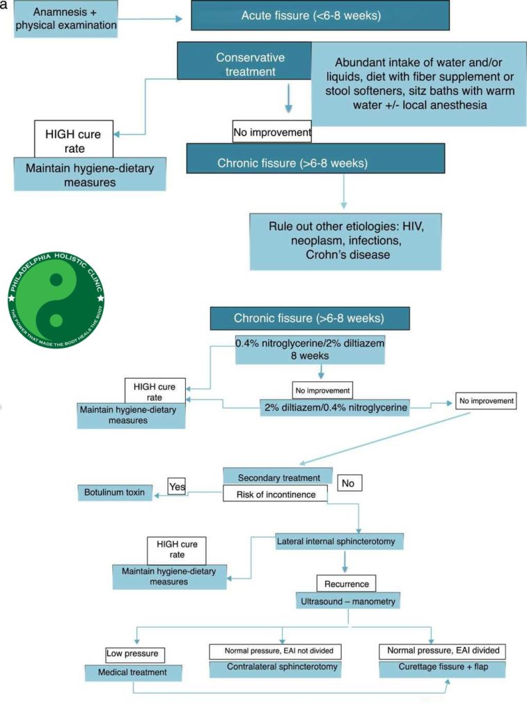 Treatment options for anal fissures