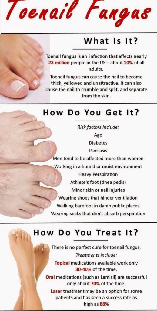 toenail fungus Info