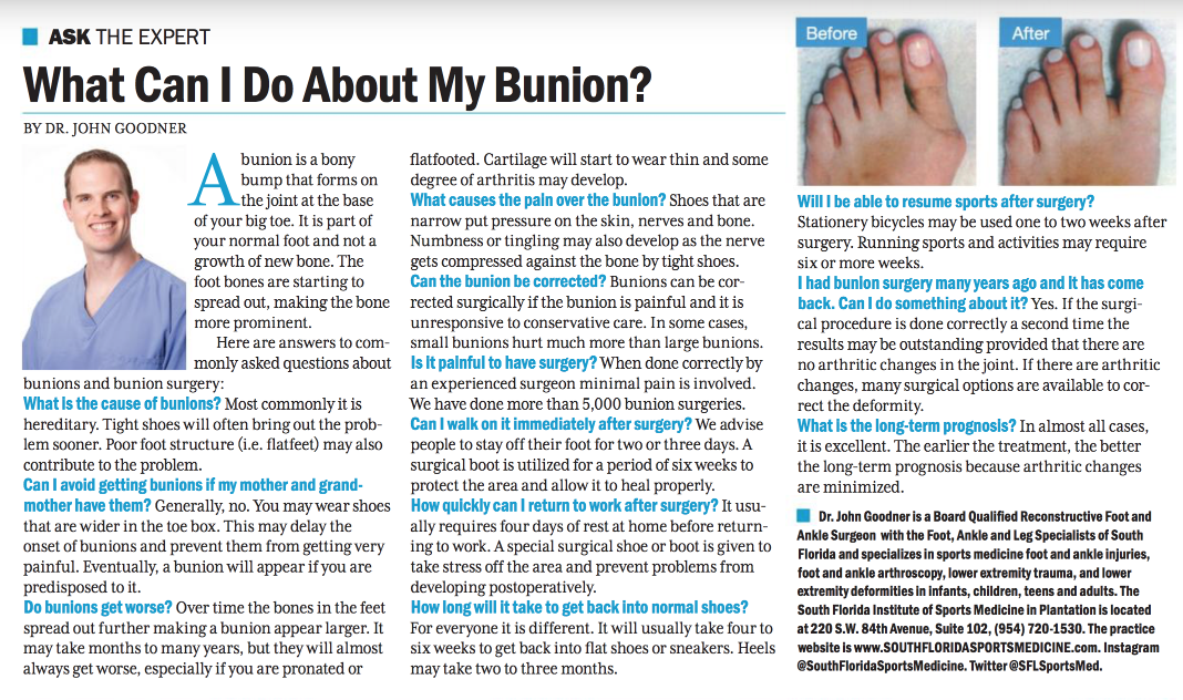 About bunions