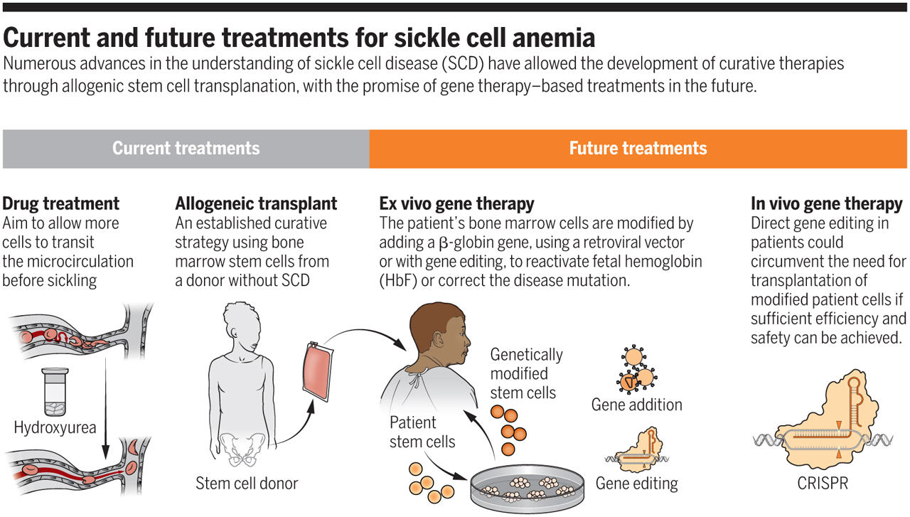 Anemia treatment for sickel