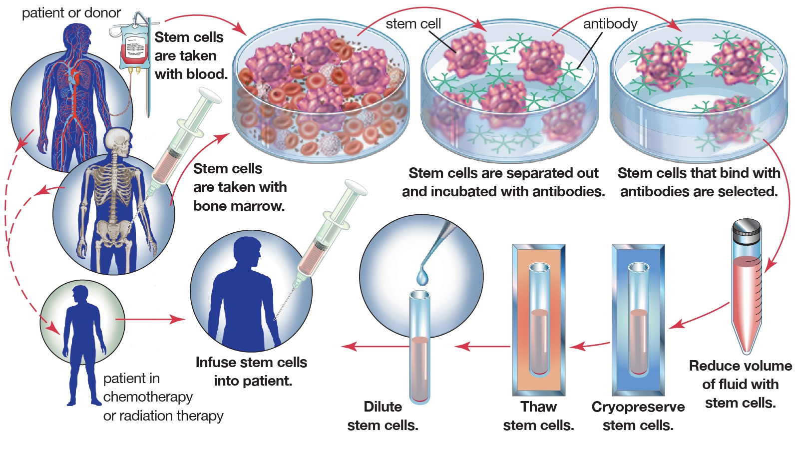 Bone Marrow Transplant