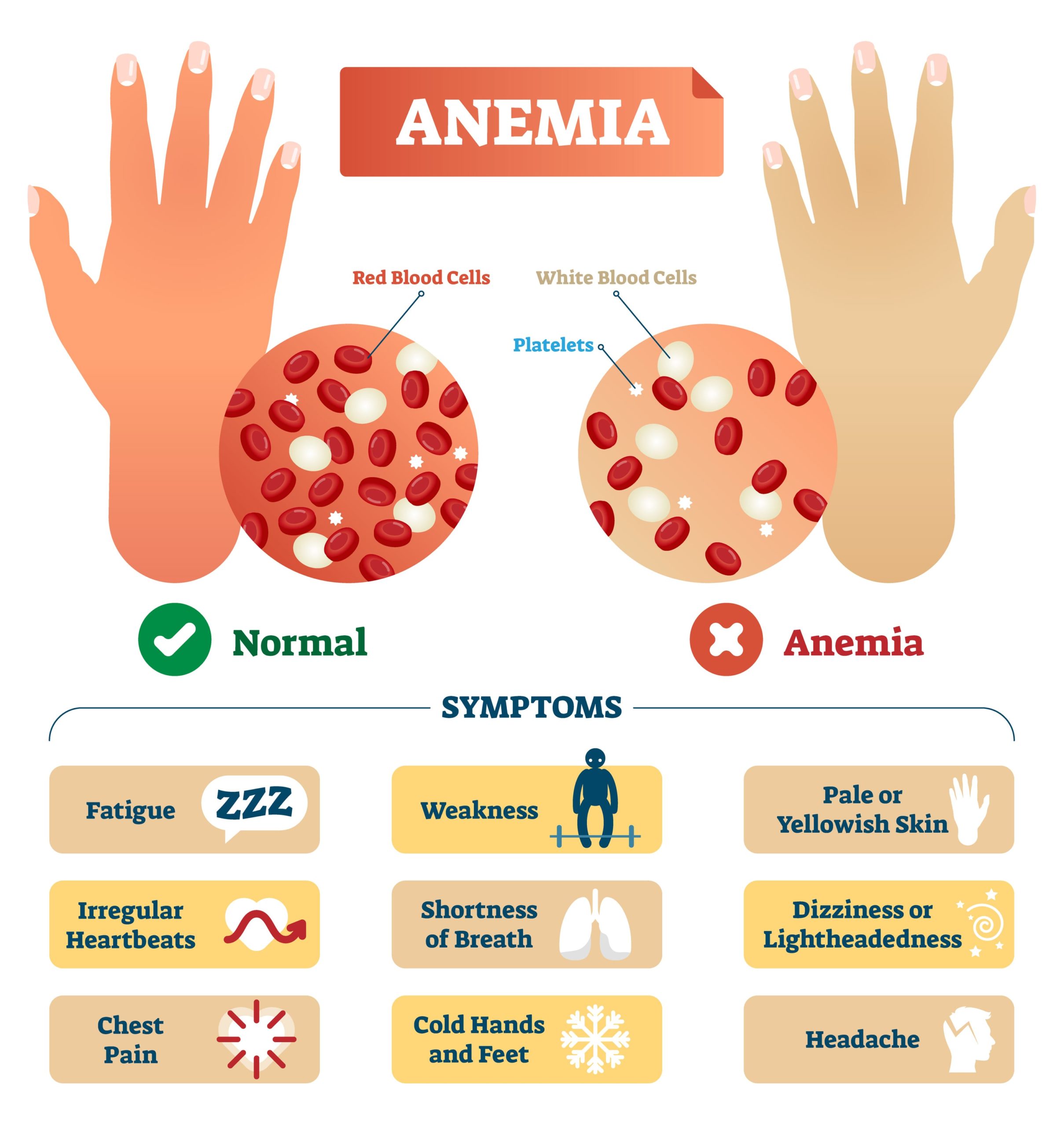 Iron-Deficiency Anemia