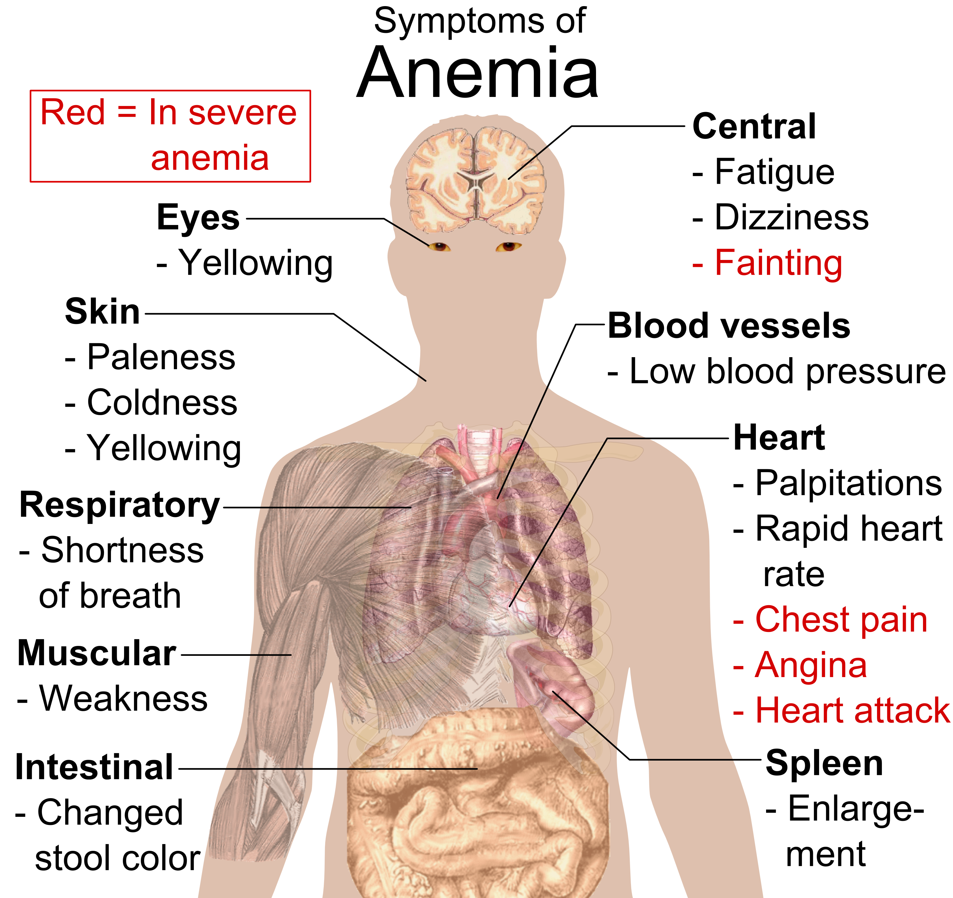 Symptoms of anemia