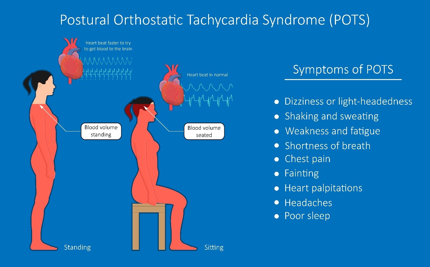 Postural orthostatic tachycardia syndrome